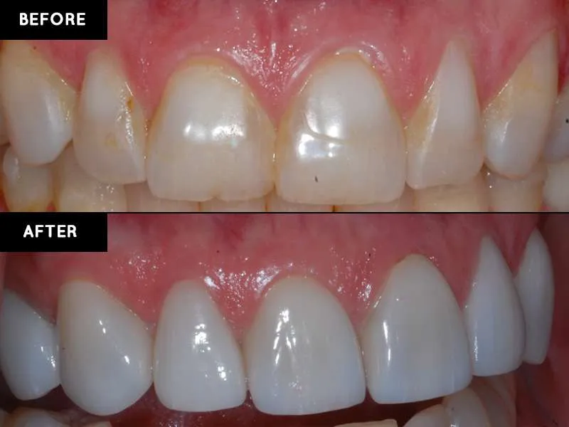 Augusta_Georgia_cosmetic_dentistry