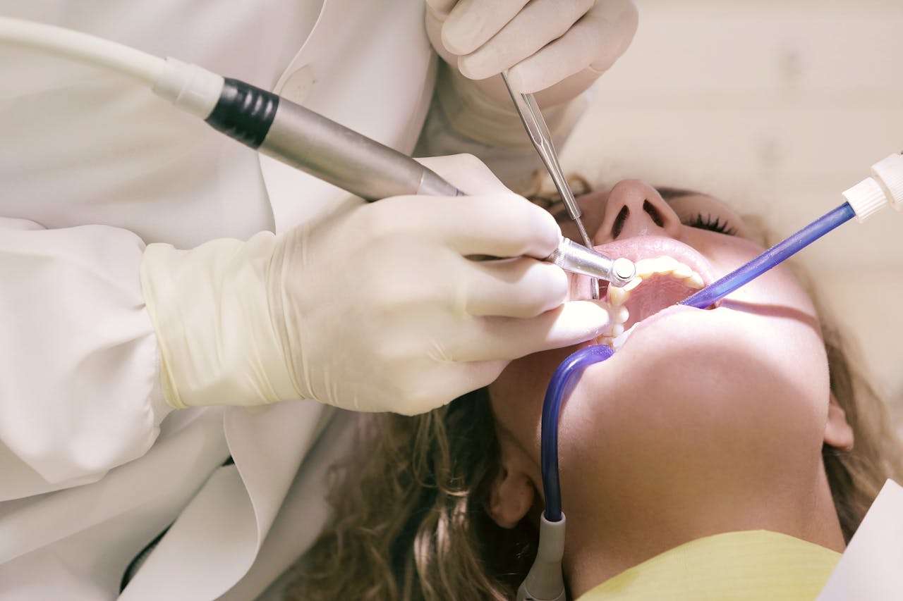 deep cleaning for teeth deep cleaning for teeth