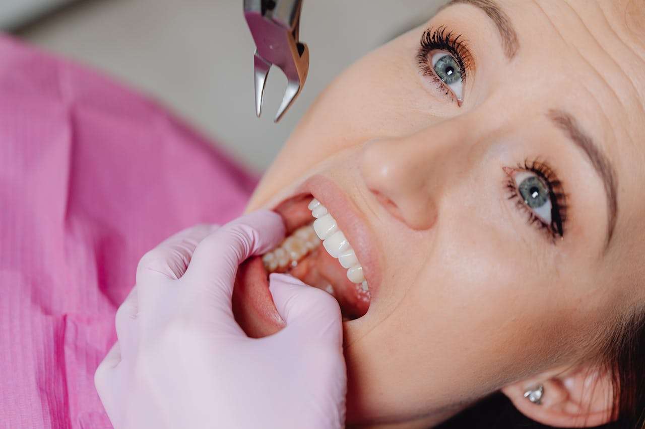 how to get over dental anxiety